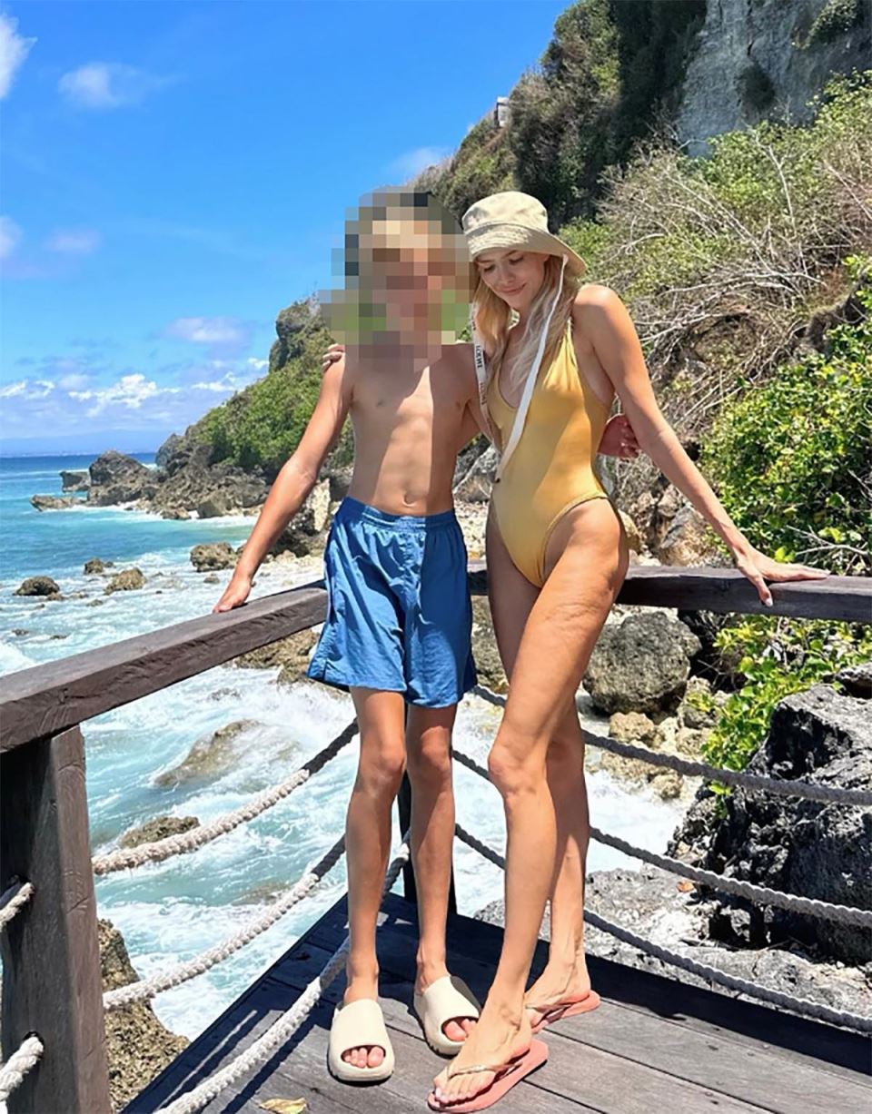 Elena Perminova ima celulit