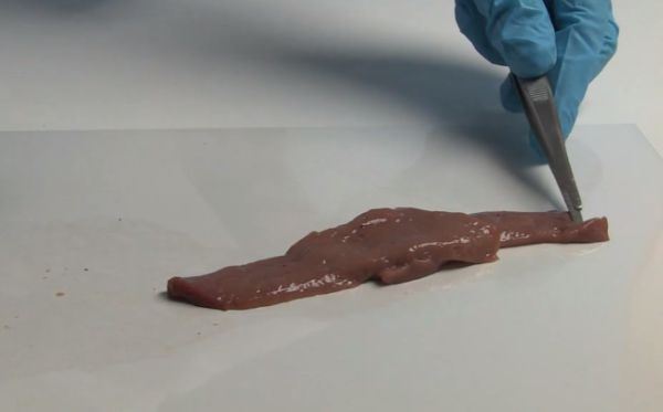 Revolucija u hirurgiji - lepak na bazi nano čestica zatvara rane za nekoliko sekundi (FOTO)