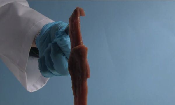 Revolucija u hirurgiji - lepak na bazi nano čestica zatvara rane za nekoliko sekundi (FOTO)